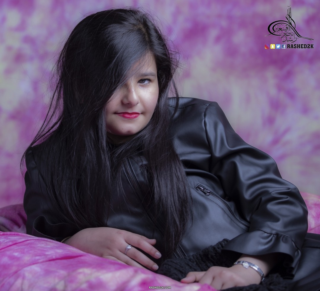 خجل الطفولة